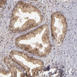 EFS Polyclonal Antibody:Antibodies, Polyclonal