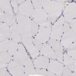 EFS Polyclonal Antibody:Antibodies, Polyclonal