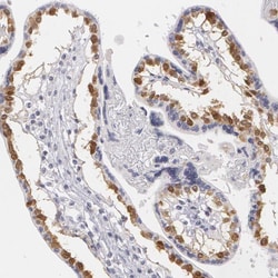 Invitrogen MBNL3 Polyclonal Antibody 100 &mu;L; Unconjugated:Antibodies,