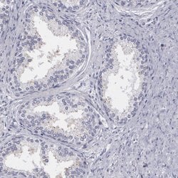 Invitrogen MBNL3 Polyclonal Antibody 100 &mu;L; Unconjugated:Antibodies,