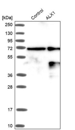 ALX1 Rabbit anti-Human, Polyclonal, Invitrogen 100 &mu;L; Unconjugated:Antibodies,