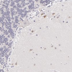 Invitrogen FAM181A Polyclonal Antibody 100 &mu;L; Unconjugated:Antibodies,