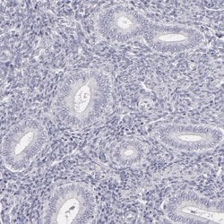 Invitrogen FAM181A Polyclonal Antibody 100 &mu;L; Unconjugated:Antibodies,