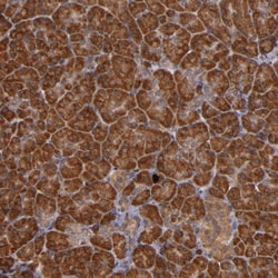 RIOK3 Polyclonal Antibody:Antibodies, Polyclonal