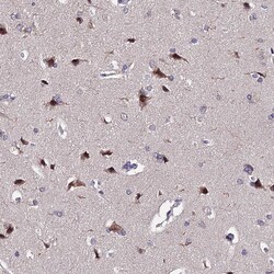 Invitrogen INPP4A Polyclonal Antibody 100 &mu;L | Buy Online | Invitrogen&trade; | Fisher Scientific