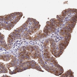 Invitrogen INPP4A Polyclonal Antibody 100 &mu;L | Buy Online | Invitrogen&trade; | Fisher Scientific