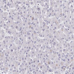 Invitrogen INPP4A Polyclonal Antibody 100 &mu;L | Buy Online | Invitrogen&trade; | Fisher Scientific