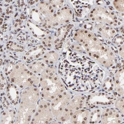Invitrogen RBM22 Polyclonal Antibody 100 &mu;L; Unconjugated:Antibodies,