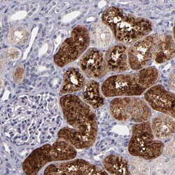 RBP4 Polyclonal Antibody:Antibodies, Polyclonal