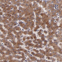 RBP4 Polyclonal Antibody:Antibodies, Polyclonal