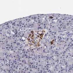 RBP4 Polyclonal Antibody:Antibodies, Polyclonal