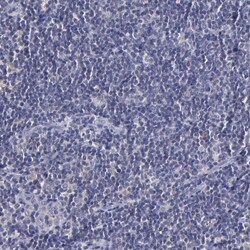 RBP4 Polyclonal Antibody:Antibodies, Polyclonal