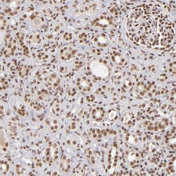 ZNF148 Polyclonal Antibody:Antibodies, Polyclonal