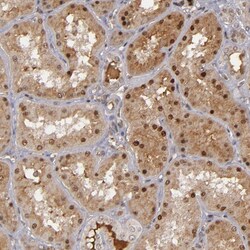 Invitrogen ZNF234 Polyclonal Antibody 100 &mu;L | Buy Online | Invitrogen&trade; | Fisher Scientific