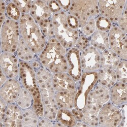 Invitrogen ZNF75A Polyclonal Antibody 100 &mu;L; Unconjugated:Antibodies,
