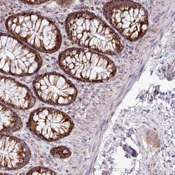 Invitrogen ZNF81 Polyclonal Antibody 100 &mu;L; Unconjugated:Antibodies,