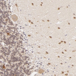 SAP102 Polyclonal Antibody:Antibodies, Polyclonal