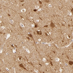 SAP102 Polyclonal Antibody:Antibodies, Polyclonal