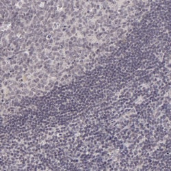 SAP102 Polyclonal Antibody:Antibodies, Polyclonal