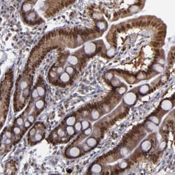 Invitrogen RREB1 Polyclonal Antibody 100 &mu;L; Unconjugated:Antibodies,