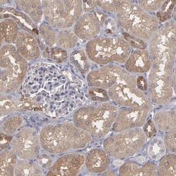 Invitrogen SEMA3G Polyclonal Antibody 100 &mu;L; Unconjugated:Antibodies,