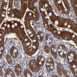 Invitrogen SEMA3G Polyclonal Antibody 100 &mu;L; Unconjugated:Antibodies,