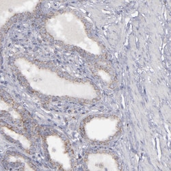 MYOM2 Polyclonal Antibody:Antibodies, Polyclonal