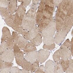 MYOM2 Polyclonal Antibody:Antibodies, Polyclonal