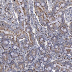 MYOM2 Polyclonal Antibody:Antibodies, Polyclonal