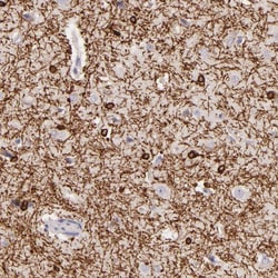 Invitrogen ZC3H7B Polyclonal Antibody 100 &mu;L; Unconjugated:Antibodies,