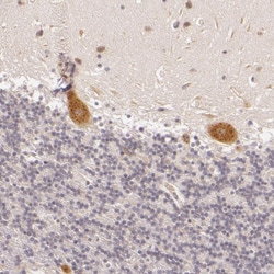 Invitrogen C14orf37 Polyclonal Antibody 100 &mu;L; Unconjugated:Antibodies,