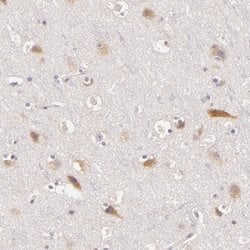 Invitrogen C14orf37 Polyclonal Antibody 100 &mu;L; Unconjugated:Antibodies,