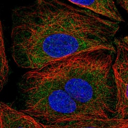 Invitrogen SAV1 Polyclonal Antibody 100 &mu;L; Unconjugated:Antibodies,