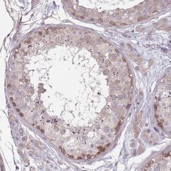 Invitrogen SAV1 Polyclonal Antibody 100 &mu;L; Unconjugated:Antibodies,