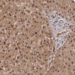 Invitrogen ITIH4 Polyclonal Antibody 100 &mu;L; Unconjugated:Antibodies,