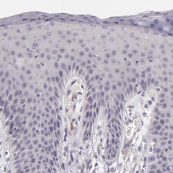 Invitrogen EGFL6 Polyclonal Antibody 100 &mu;L; Unconjugated:Antibodies,