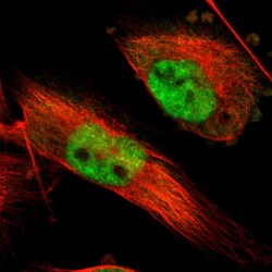 INTS6 Polyclonal Antibody:Antibodies, Polyclonal