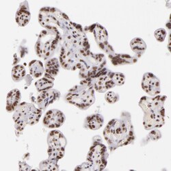 INTS6 Polyclonal Antibody:Antibodies, Polyclonal