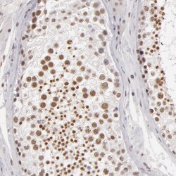 INTS6 Polyclonal Antibody:Antibodies, Polyclonal