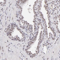 INTS6 Polyclonal Antibody:Antibodies, Polyclonal