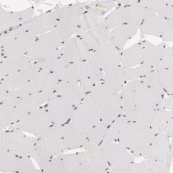 INTS6 Polyclonal Antibody:Antibodies, Polyclonal