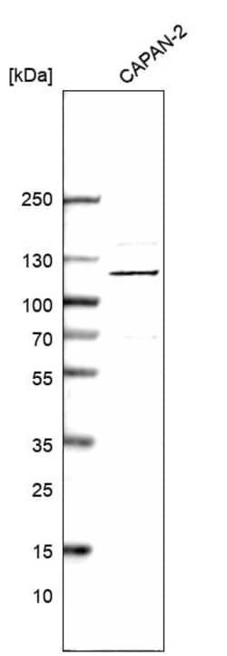 Invitrogen INTS6 Polyclonal Antibody 100 &mu;L; Unconjugated:Antibodies,