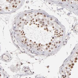 INTS6 Polyclonal Antibody:Antibodies, Polyclonal