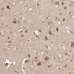 Invitrogen TMOD3 Polyclonal Antibody 100 &mu;L; Unconjugated:Antibodies,