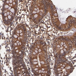 Invitrogen TMOD3 Polyclonal Antibody 100 &mu;L; Unconjugated:Antibodies,