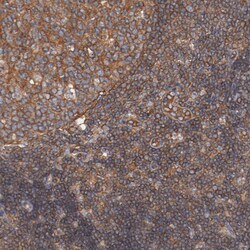 Invitrogen TMOD3 Polyclonal Antibody 100 &mu;L; Unconjugated:Antibodies,