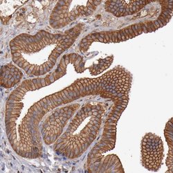 Invitrogen TMOD3 Polyclonal Antibody 100 &mu;L; Unconjugated:Antibodies,