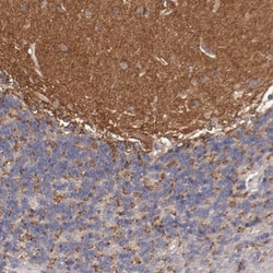 FAT1 Polyclonal Antibody:Antibodies, Polyclonal