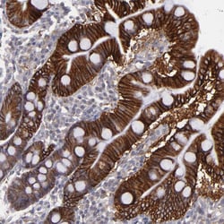 FAT1 Polyclonal Antibody:Antibodies, Polyclonal