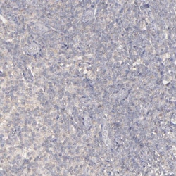 FAT1 Polyclonal Antibody:Antibodies, Polyclonal